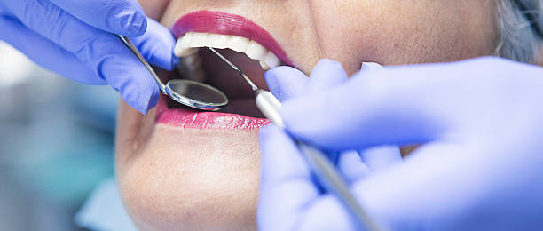 Best Emergency Broken Tooth Repair in Bremen, OH